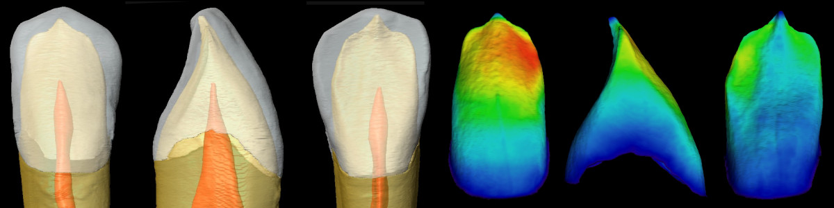 Carrusel - Antropología dental 1