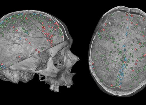 Gallareto-Sande et al AR2026-Bruner