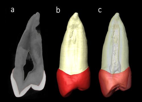 Sima de los Huesos premolars