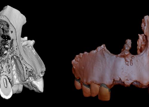 Imágenes micro-CT de un maxilar fósil de 'Homo antecessor'/Laura Martín-Francés