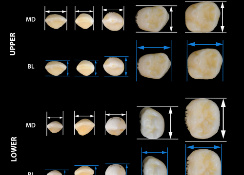 Diámetro de dientes de leche/Martínez de Pinillos