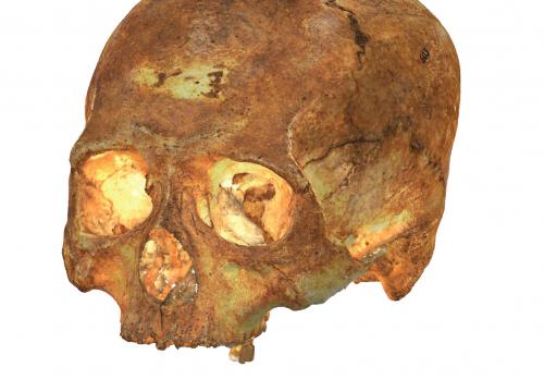 Crania with oblique tabular deformation/G. Rangel de Lázaro et al