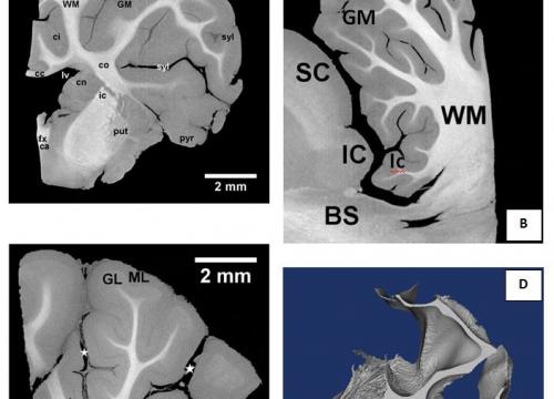 Nueva técnica para visualizar tejido cerebral