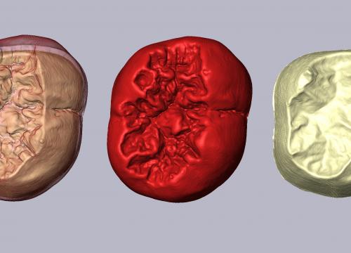 Novedoso estudio morfológico ratifica las similitudes entre Homo antecessor y Homo sapiens