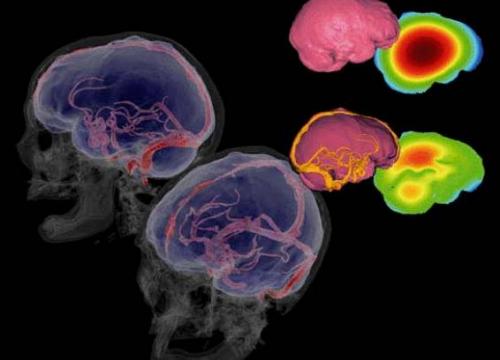 Científicos del CENIEH presentan un método pionero para conocer la fisiología cerebral de los fósiles