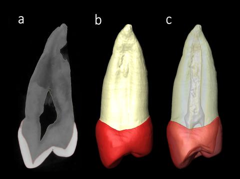Premolar de Sima de los Huesos: a