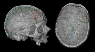 Gallareto-Sande et al AR2026-Bruner