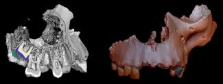 Imágenes micro-CT de un maxilar fósil de 'Homo antecessor'/Laura Martín-Francés Imágenes micro-CT de un maxilar fósil de 'Homo antecessor'/Laura Martín-Francés