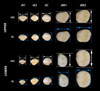 Diámetro de dientes de leche/Martínez de Pinillos
